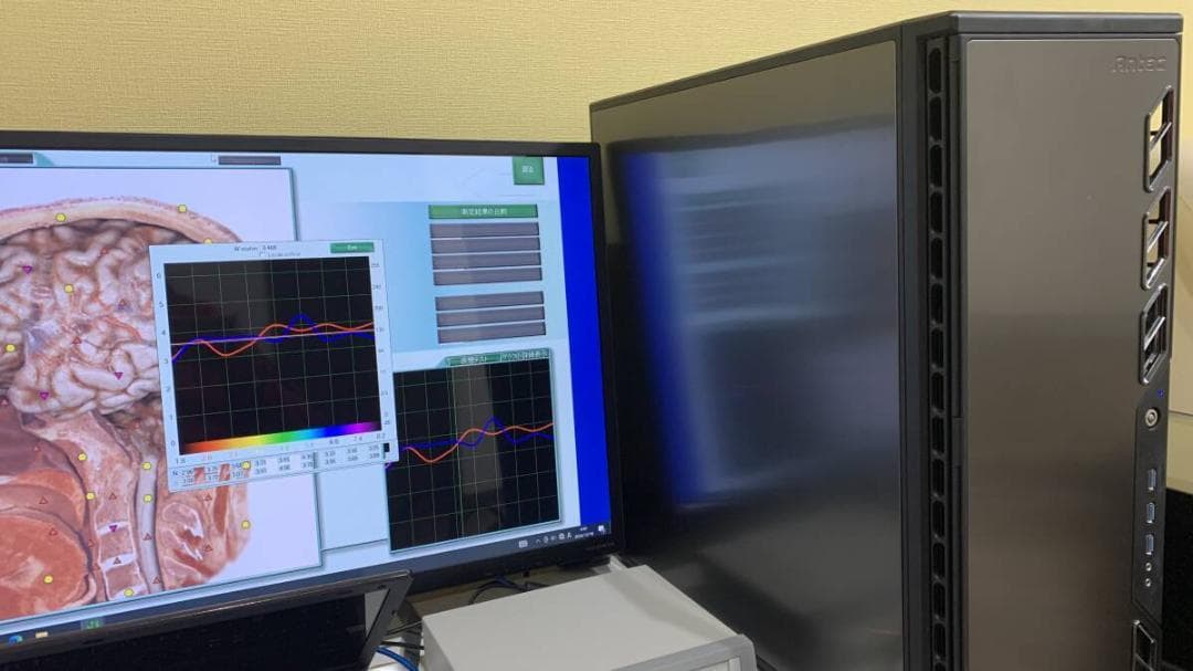 量子波動測定 メタトロン本体＋専用NutriSoft搭載PC×２台 価格交渉可能 画像3