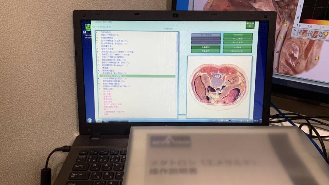 量子波動測定 メタトロン本体＋専用NutriSoft搭載PC×２台 価格交渉可能 画像4